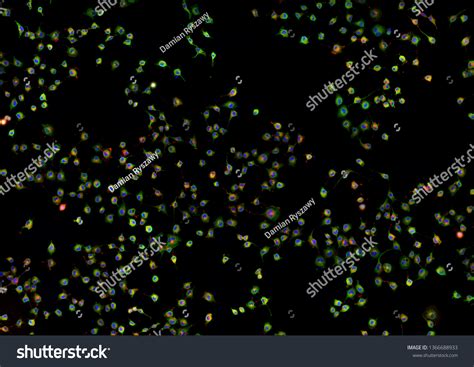 Real Fluorescence Microscopic View Cancer Cells Stock Photo 1366688933