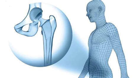 Hip And Total Hip Replacement Surgery Treatment Depuy Synthes