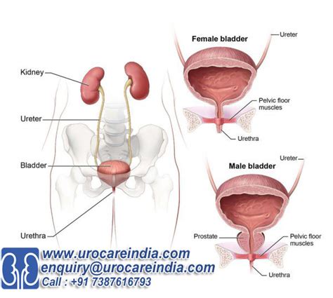 Medical Value Travel India