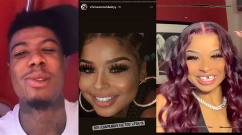 Blueface Gf Chriseanrock Says She Is Going To Remove The Tooth For Blue