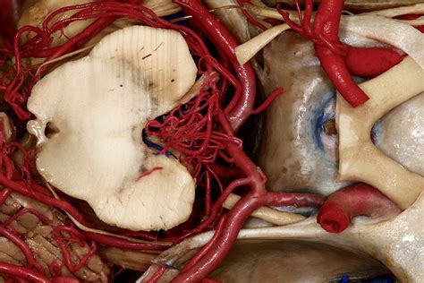 Transverse View of Midbrain at Level of Sella Turcica | Neuroanatomy