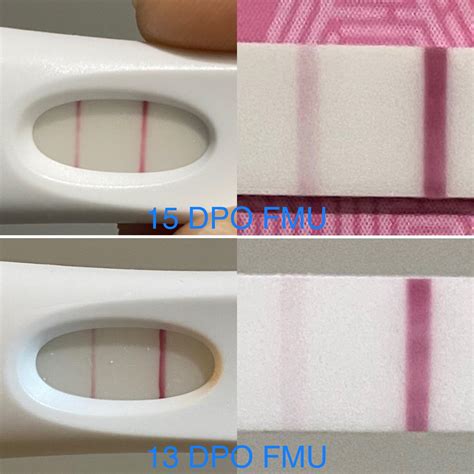 13 15 Dpo Frer Pregmate Does This Progression Look Okay I Thought