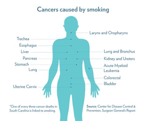 Tobacco Cessation Hollings Cancer Center Musc Charleston Sc