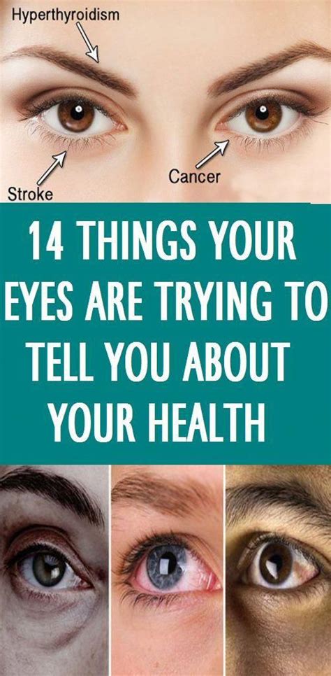 14 Things Your Eyes Are Trying To Tell You About Your Health In 2020