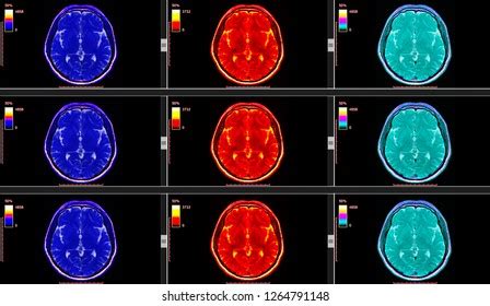 Perfusion Ct Scan Image Brain 3d 스톡 일러스트 1513433276 Shutterstock