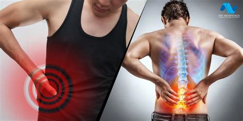 How To Tell Kidney Pain From Back Pain Discover 10 Signs And Symptoms