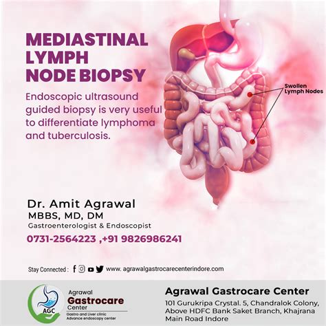 Mediastinal Lymph Node Biopsy Agrawal Gastrocare Center Indore