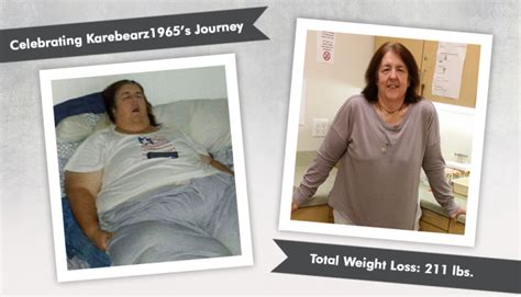 Before And After Rny With Karebearz1965 Losing 211 Pounds Obesityhelp