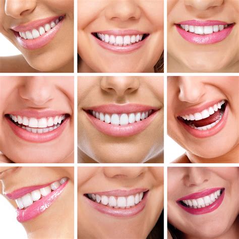 Healthy Teeth For A Beautiful Smile Orthodontic Blog Myorthodontists Info