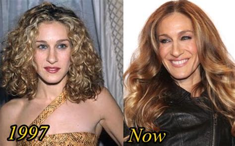 Sarah Jessica Parker Plastic Surgery Before And After Plastic Surgery Hits