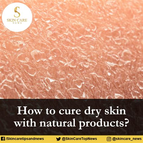 How To Cure Dry Skin On Face With Natural Products