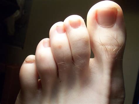 Normal Foot Flickr Photo Sharing