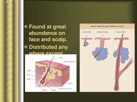 Ppt Disorders Of Sebaceous Glands Powerpoint Presentation Free
