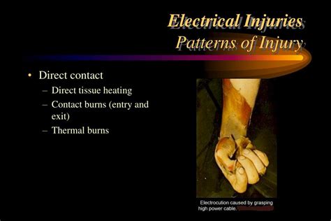 Ppt Electrical Injuries Powerpoint Presentation Free Download Id