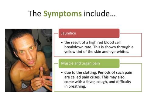 PPT Sickle Cell Anemia PowerPoint Presentation Free Download ID