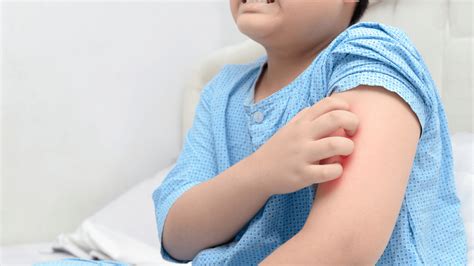 Covid 19 Symptoms In Babies Rash Children And Coronavirus Multiple