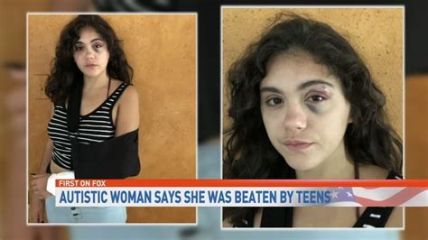 woman with autism allegedly viciously attacked by group of teenage girls woai