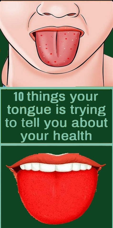 What Your Tongue Says About Your Health Health And Wellness Quotes Health Healthy Health
