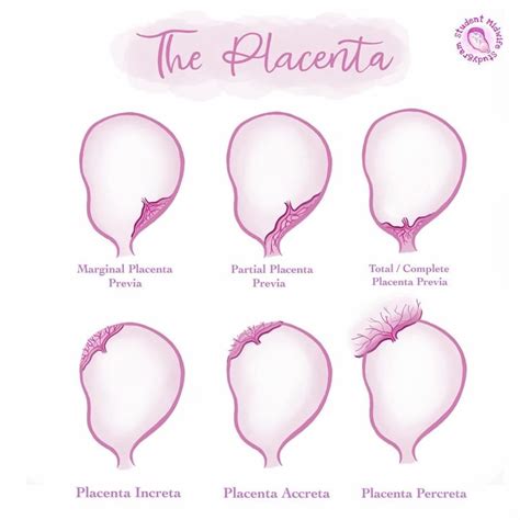 The Placenta Anatomy Human Placenta Midwifery Placent