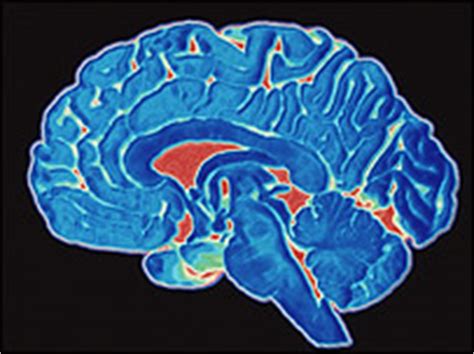 El sexo del cerebro música nacionalismo y tecnología