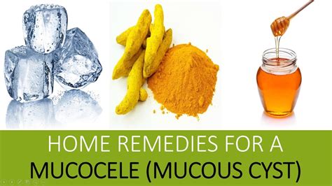 Home Remedies For A Mucocele Mucous Cyst Home Remedies To Treat