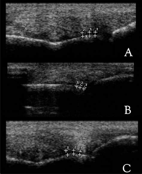 Longitudinal Ultrasound Views From A Thoroughbred MCP Joint A Download Scientific Diagram