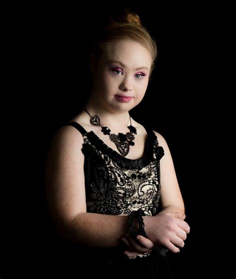 Chorea huntington (veitstanz) station 4: A Teen With Down Syndrome Just Landed A Modelling Contract ...