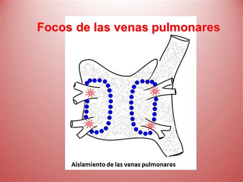 Venas Pulmonares ¿qué Son Anatomía Función Ecocardiografía Y Más