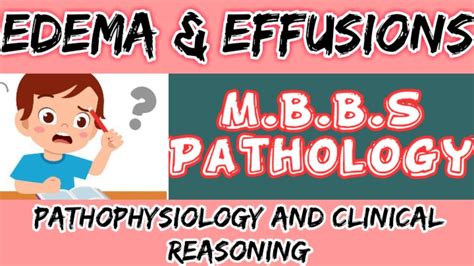 Edema And Effusions Mbbs Pathophysiology And Clinical Reasoning Neet
