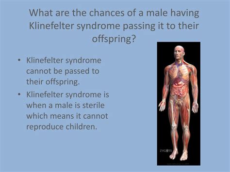 Ppt Klinefelter Syndrome Powerpoint Presentation Free Download Id6730570