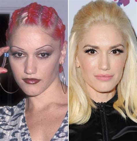Gwen Stefani Plastic Surgery Nose Job Botox After And Before