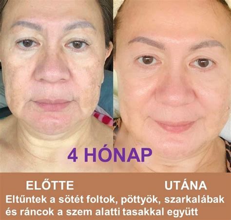Lifewave X39 Before And After Ethosvision