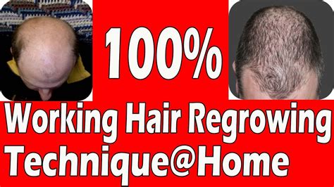 10 Tips To Naturally Regrow Your Hair 100 Working Technique Try At Home Youtube