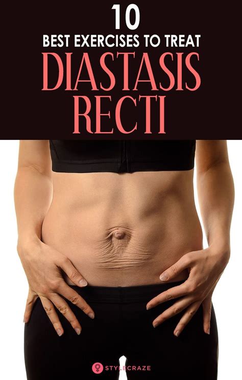 10 Exercises For Diastasis Recti That Strengthen Your Core Diastasis