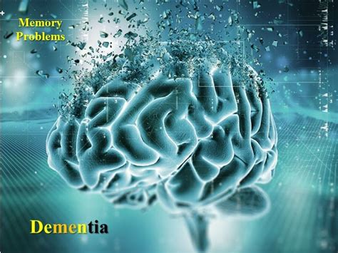 What Is Dementia Dr Vikram Sharma Explains