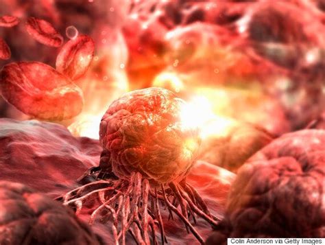 Breakthrough Cancer Discovery Could Treat 90 Of Tumours Scientists
