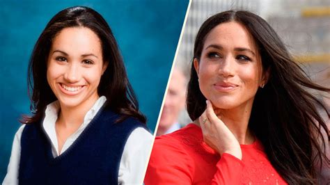 Before And After Did Meghan Markle Have A Nose Job