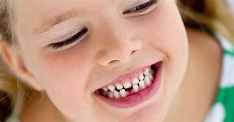 Replace it in the socket facing the correct way. My Child Has a Loose Tooth - Now What? - Love and Marriage