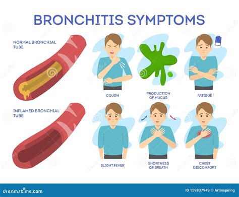Chronic Bronchitis Causes Symptoms Diagnosis Treatmen