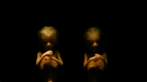 The Bizarre True Story Of The Silent Twins