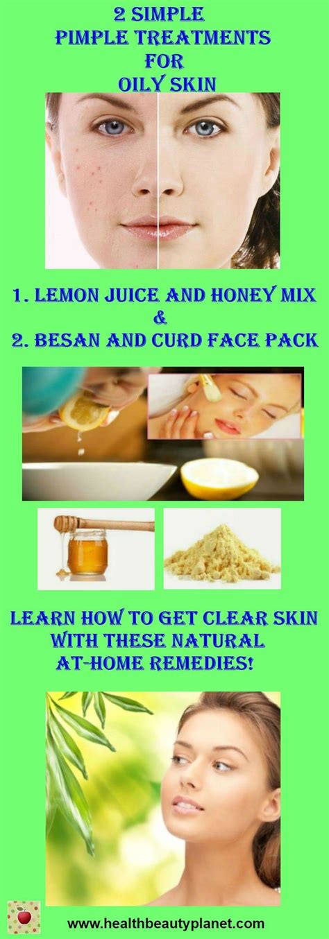 2 Simple Pimple Treatments For Oily Skin Oily Skin Treatment Pimple Treatment Oily Skin