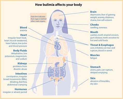 Common Bulimia Medical Complications — Balance Eating Disorder