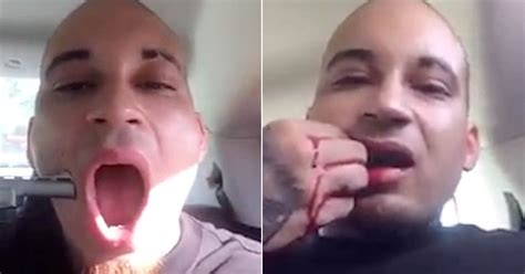 Us Rapper Shoots Himself In The Face In Attempt To Be Famous World