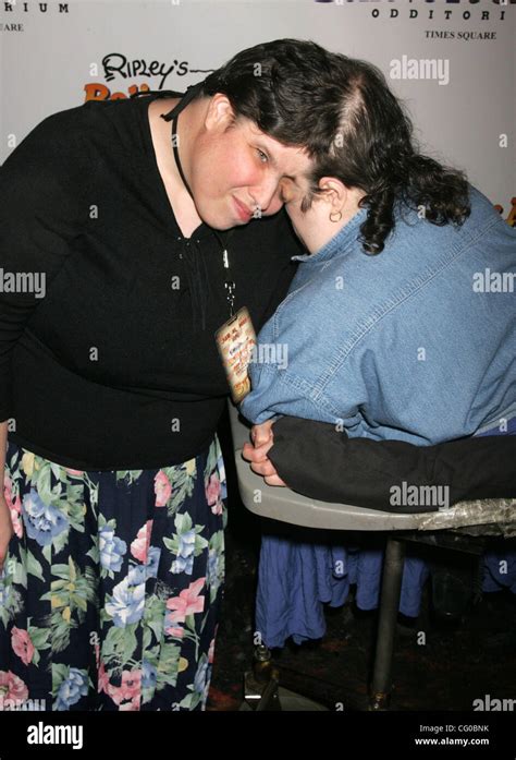 Jun 21 2007 New York Ny Usa Oldest Living Set Of Female Conjoined