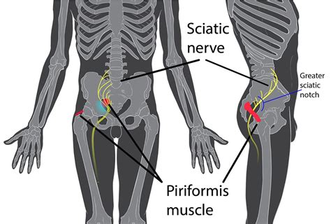 The hip flexors are a group of muscles around the top of the thighs that connect the. Inner Thigh Pain | HealDove