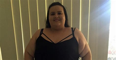 Obese Student Goes From Granny To Bikini Body After Shedding 14 Stone