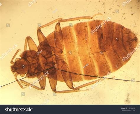 Bed Bug Light Microscope Stock Photo 757568392 Shutterstock