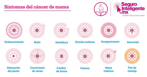 Cancer De Mama Conoce Cuales Son Los Sintomas Y Causas Del Cancer De