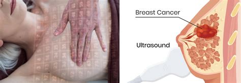 Clinical Breast Exam US More Accurate Than Mammogram
