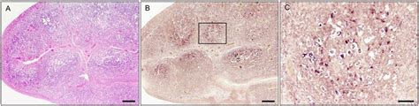 Histology Of Hyperplasia Tonsillitis A And In Situ Hybridization